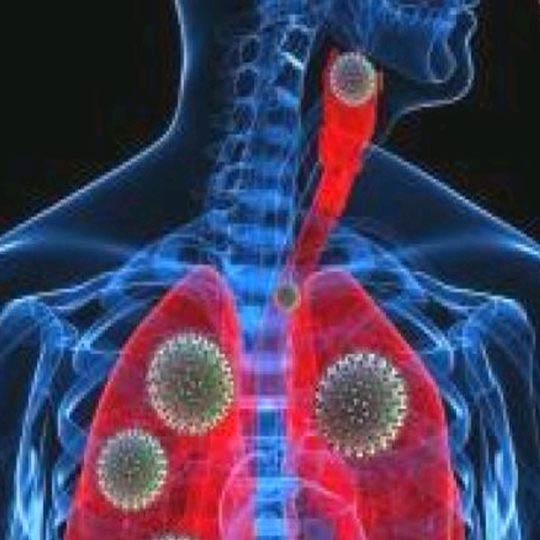 dotth2o it legionella-alghe-corrosione-tubi-calcare-acqua-jesi-ancona-abruzzo 004